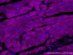RYR2 Antibody in Immunohistochemistry (Paraffin) (IHC (P))