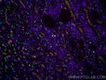 CD3 Antibody in Immunohistochemistry (Paraffin) (IHC (P))