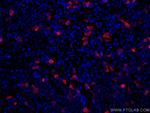 6x His, His-Tag Antibody in Immunocytochemistry (ICC/IF)