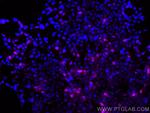 DYKDDDDK tag Antibody in Immunocytochemistry (ICC/IF)