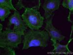 HDAC1 Antibody in Immunocytochemistry (ICC/IF)