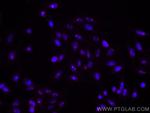 IMP3 Antibody in Immunocytochemistry (ICC/IF)
