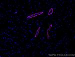smooth muscle actin Antibody in Immunohistochemistry (Paraffin) (IHC (P))