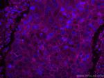 ALCAM Antibody in Immunohistochemistry (Paraffin) (IHC (P))
