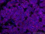 SERBP1 Antibody in Immunohistochemistry (Paraffin) (IHC (P))