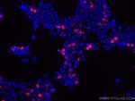 DYKDDDDK tag Antibody in Immunocytochemistry (ICC/IF)