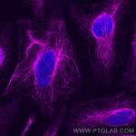 Vimentin Antibody in Immunocytochemistry (ICC/IF)