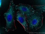Talin-1 Antibody in Immunocytochemistry (ICC/IF)