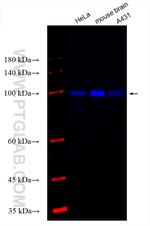 c-Cbl Antibody in Western Blot (WB)