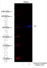 Phospho-JUN (Ser73) Antibody in Western Blot (WB)