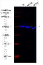PPAR Gamma Antibody in Western Blot (WB)