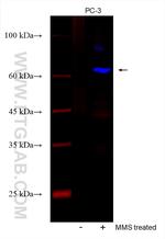 Phospho-CHEK2 (Thr68) Antibody in Western Blot (WB)