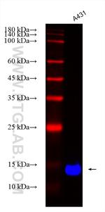 LY6D Antibody in Western Blot (WB)