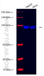 spike protein Antibody in Western Blot (WB)