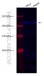 CAMP Antibody in Western Blot (WB)