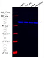 URAT1 Antibody in Western Blot (WB)