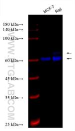 MTA3 Antibody in Western Blot (WB)