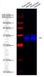 TFPI2 Antibody in Western Blot (WB)