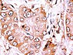 CLASP2 Antibody in Immunohistochemistry (IHC)