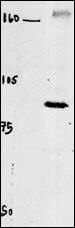 CLCN4 Antibody in Western Blot (WB)