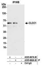 CLCC1 Polyclonal Antibody