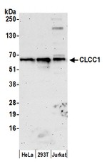 CLCC1 Polyclonal Antibody
