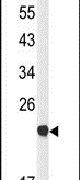Claudin 23 Antibody in Western Blot (WB)