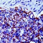 Claudin 4 Antibody in Immunohistochemistry (IHC)