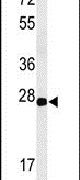 Claudin 4 Antibody in Western Blot (WB)