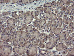CLEC4E Antibody in Immunohistochemistry (Paraffin) (IHC (P))