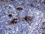 CLEC4M Antibody in Immunohistochemistry (Paraffin) (IHC (P))