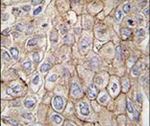 CLIC1 Antibody in Immunohistochemistry (IHC)