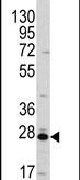 CLIC1 Antibody in Western Blot (WB)