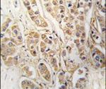 CLIC4 Antibody in Immunohistochemistry (IHC)