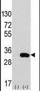 CLIC4 Antibody in Western Blot (WB)