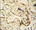 CLIC6 Antibody in Immunohistochemistry (IHC)