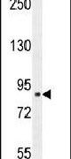 CLIC6 Antibody in Western Blot (WB)
