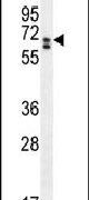 CLIP3 Antibody in Western Blot (WB)