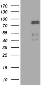CLIP4 Antibody in Western Blot (WB)