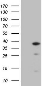 CLOCK Antibody in Western Blot (WB)