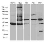 CLP1 Antibody in Western Blot (WB)