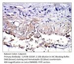 Calponin Antibody in Immunohistochemistry (IHC)