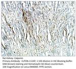 Calponin Antibody in Immunohistochemistry (IHC)