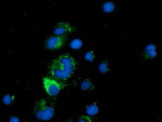 CLPP Antibody in Immunocytochemistry (ICC/IF)