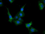 CLPP Antibody in Immunocytochemistry (ICC/IF)