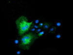 CLPP Antibody in Immunocytochemistry (ICC/IF)