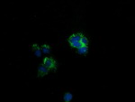 CLPP Antibody in Immunocytochemistry (ICC/IF)