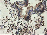 CLPP Antibody in Immunohistochemistry (Paraffin) (IHC (P))