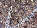 CLPP Antibody in Immunohistochemistry (Paraffin) (IHC (P))