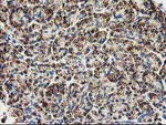 CLPP Antibody in Immunohistochemistry (Paraffin) (IHC (P))